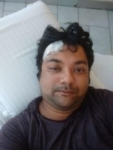 Me resting after stitch